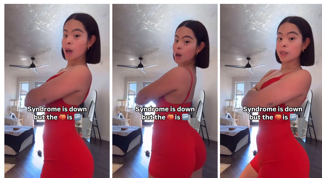 Littleminaxo Syndrome is down but the down is up